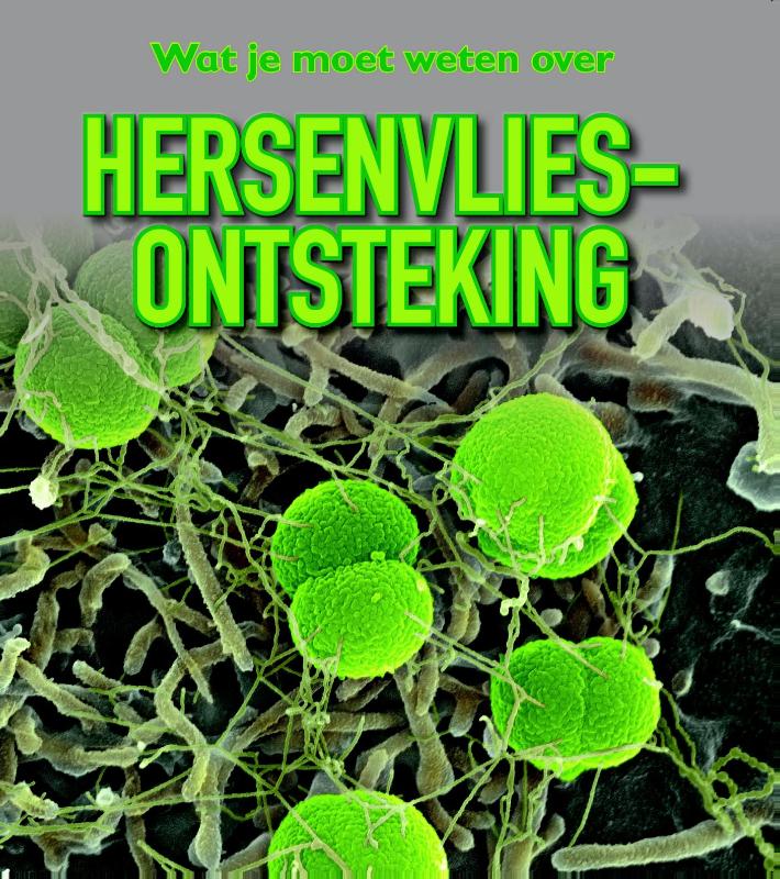 Omslag van Hersenvliesontsteking