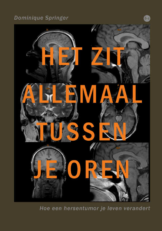Omslag van Het zit allemaal maar tussen je oren