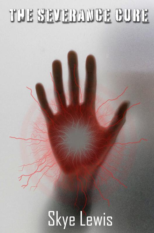 Omslag van The Severance Cure