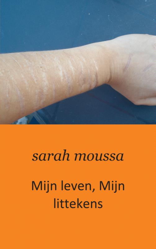 Omslag van Mijn leven, mijn littekens