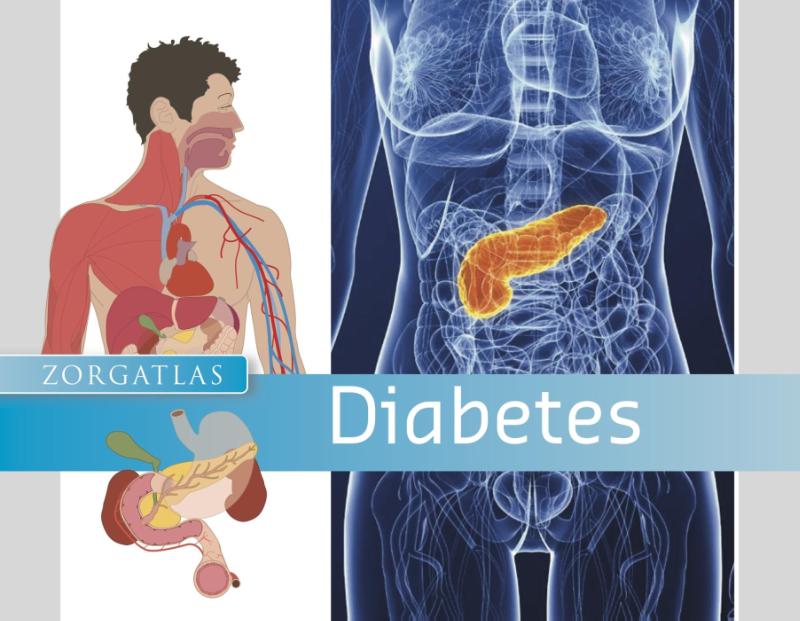 Omslag van Diabetes