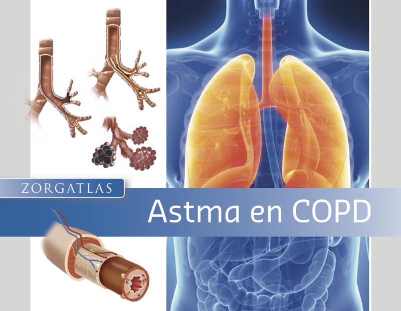 Omslag van Astma en COPD