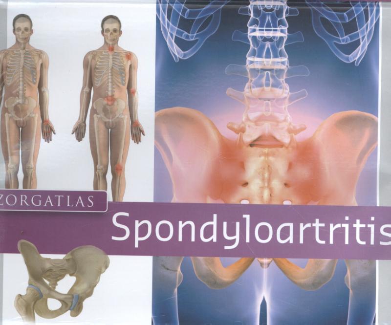 Omslag van Zorgatlas Spondyloartritis