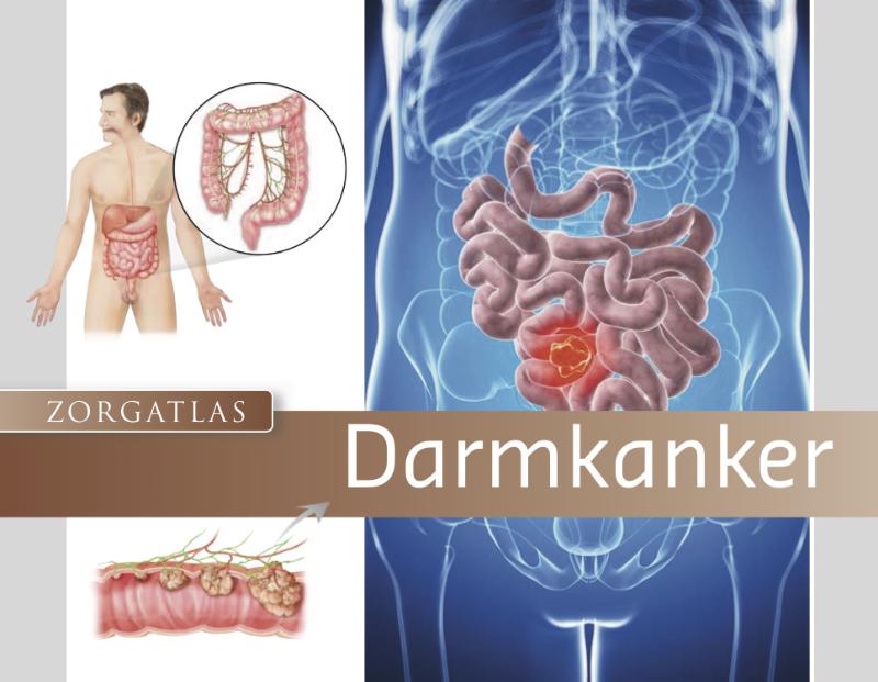 Omslag van Zorgatlas Darmkanker