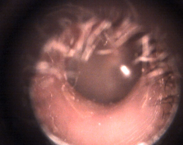 Remote medical examination of patient ear with a digital otoscope in realtime