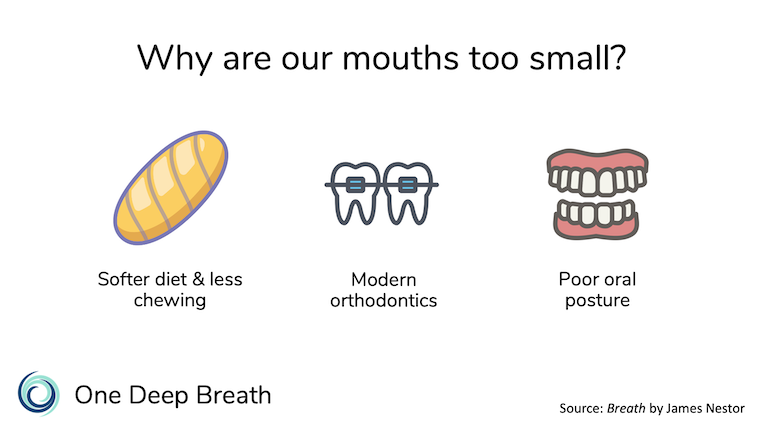 The size of our mouths and jaws are smaller and our teeth are crooked because of a shift towards softer foods, as well as orthodontic devices that constrain the mouth.