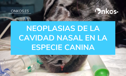 Neoplasia cavidad nasal.png