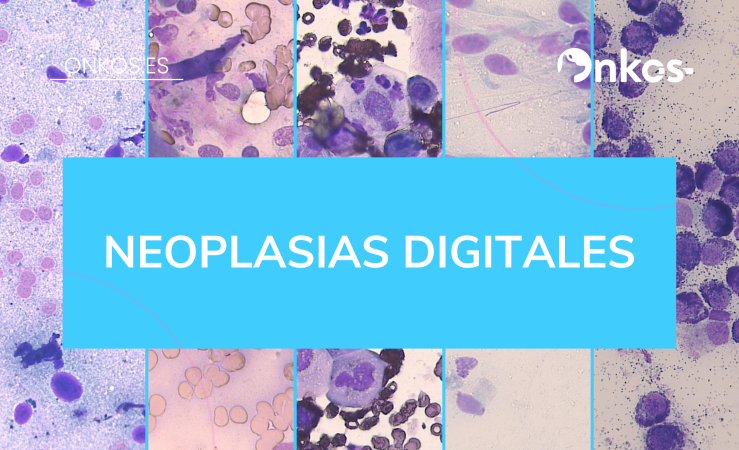 Neoplasias digitales.png