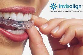 Invisalign