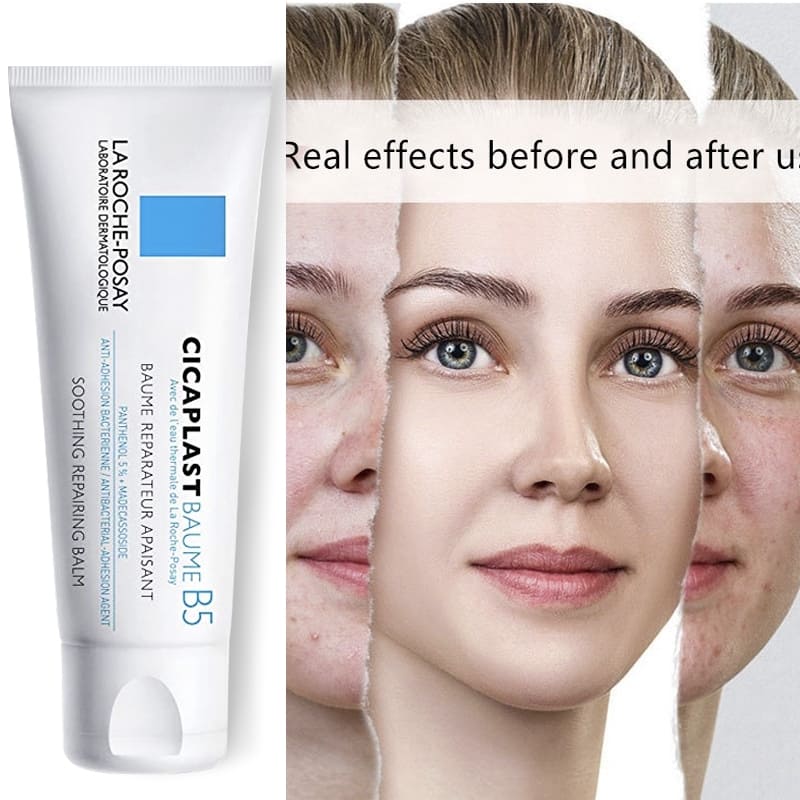 Hiệu quả phục hồi da của La Roche Posay B5