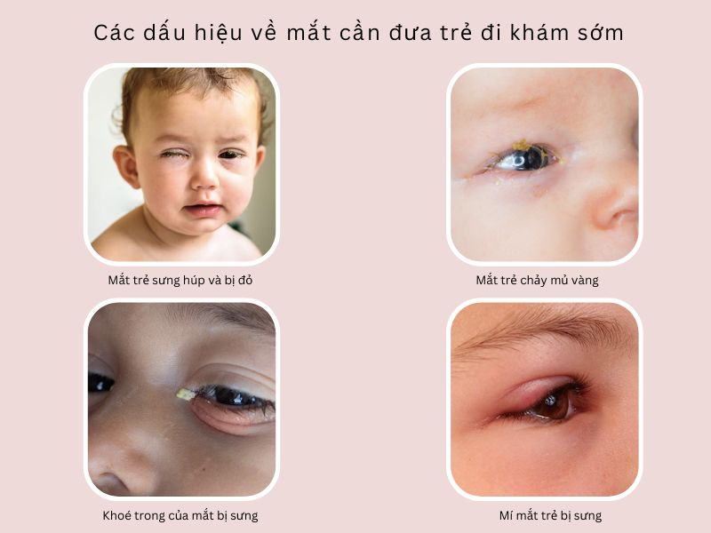 Các dấu hiệu cần đưa trẻ đi khám