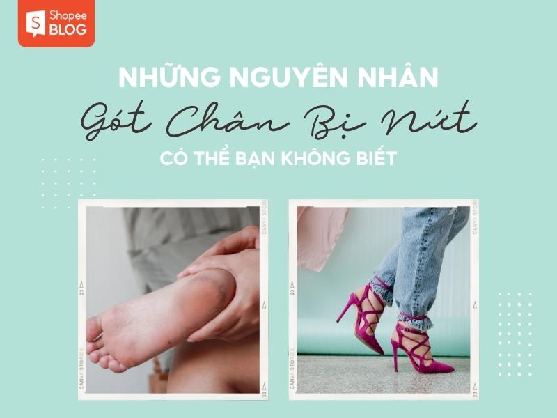 Nguyên nhân nứt gót chân rất có thể bạn không biết 