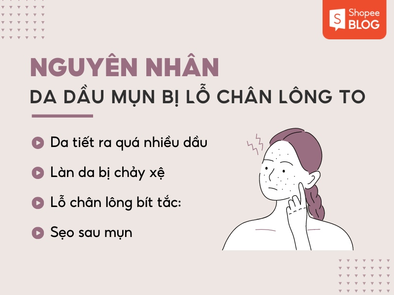 Nguyên nhân khiến da dầu mụn bị lỗ chân lông to