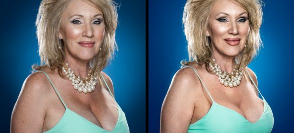 "Plastic Surgery" photo retouching campaign on Orms Connect Photographic Blog