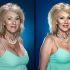 "Plastic Surgery" photo retouching campaign on Orms Connect Photographic Blog