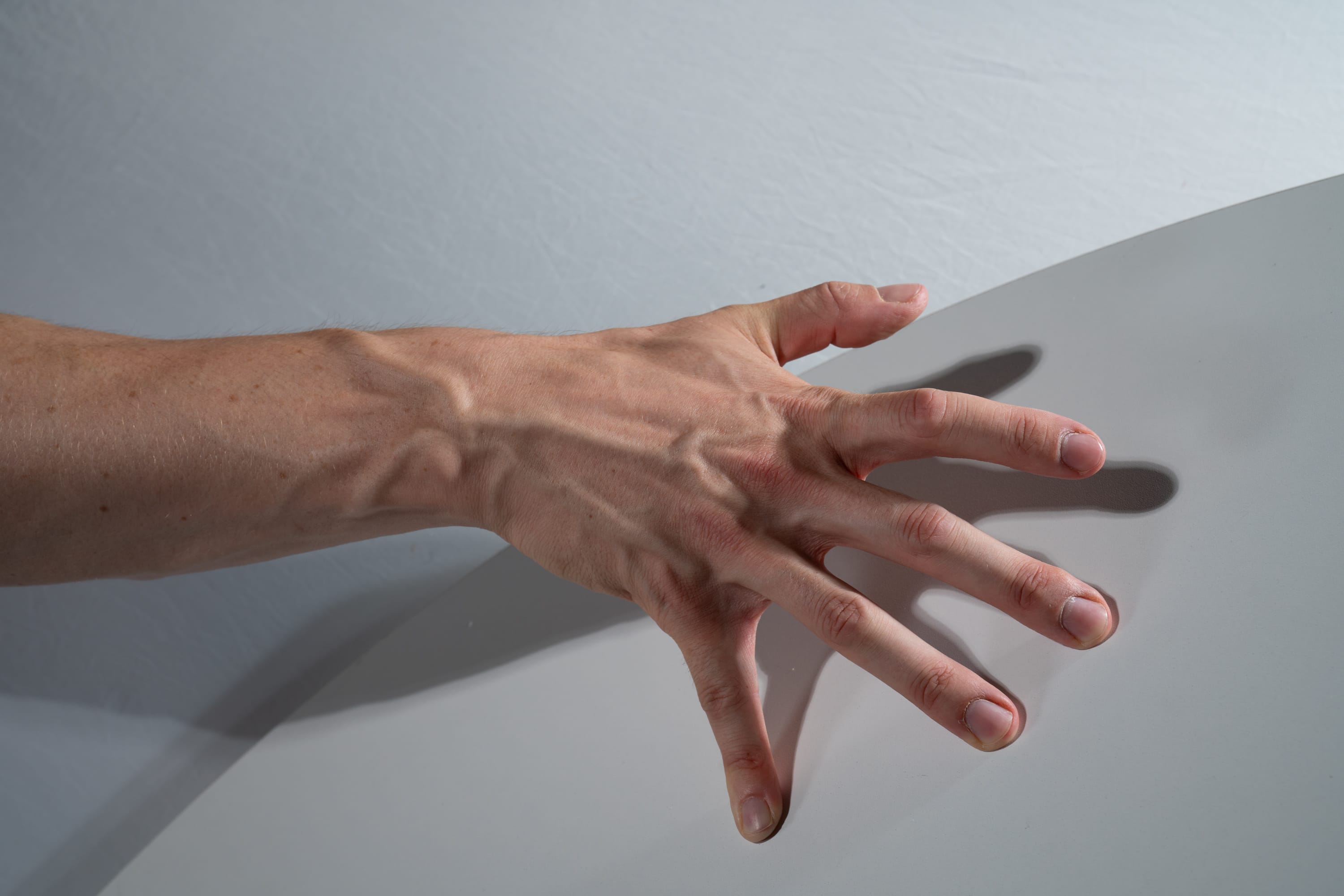 a closeup, topview image of a fairskinned hand and forearm resting on a smooth, white surface. the studio lighting casts subtle shadows highlighting the hand's details, particularly the prominent veins and blood vessels.