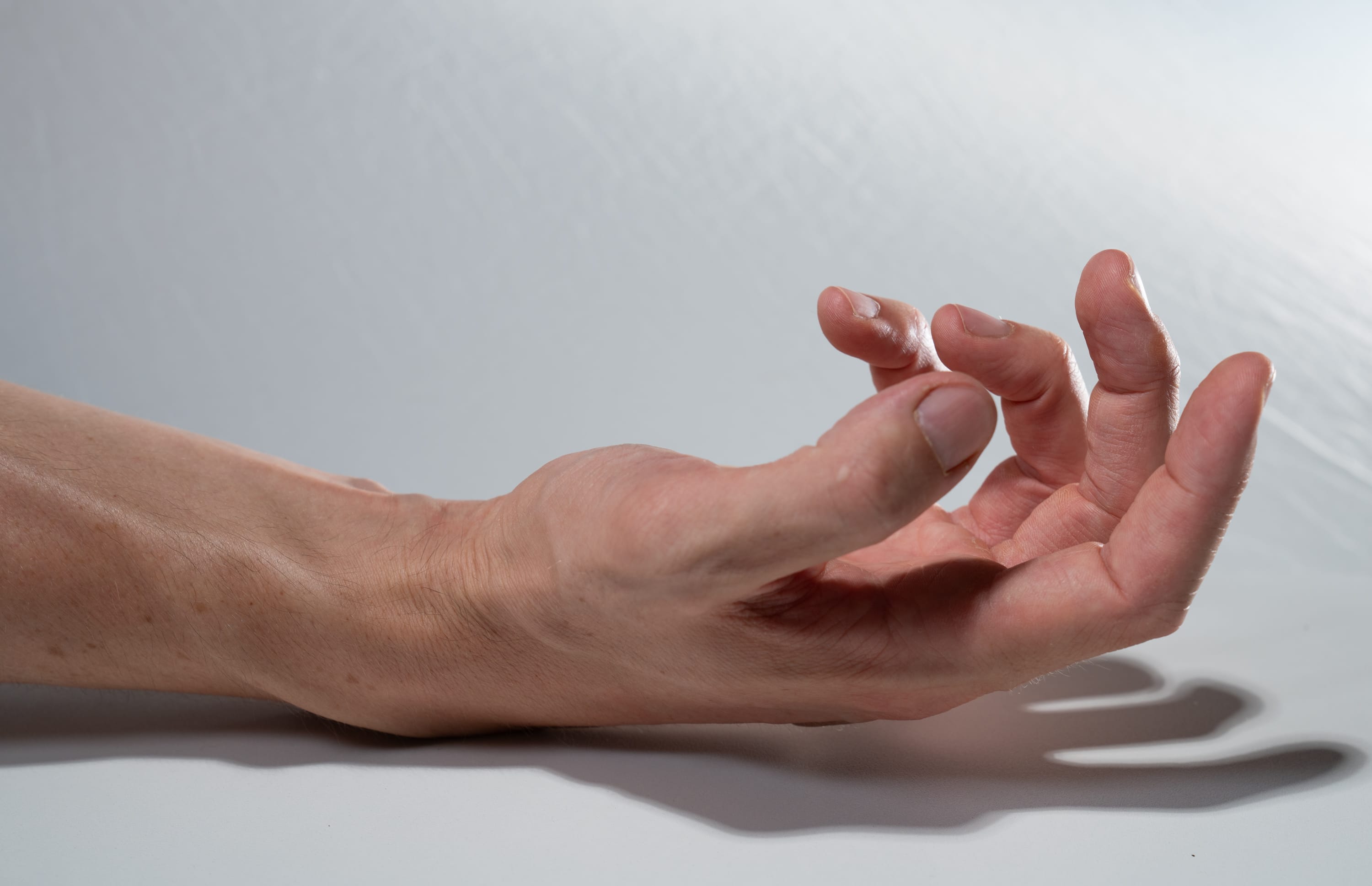 a single hand resting on a white surface, illuminated by studio lighting. the image captures the hand from a side perspective, highlighting the texture and details of the skin and fingers.