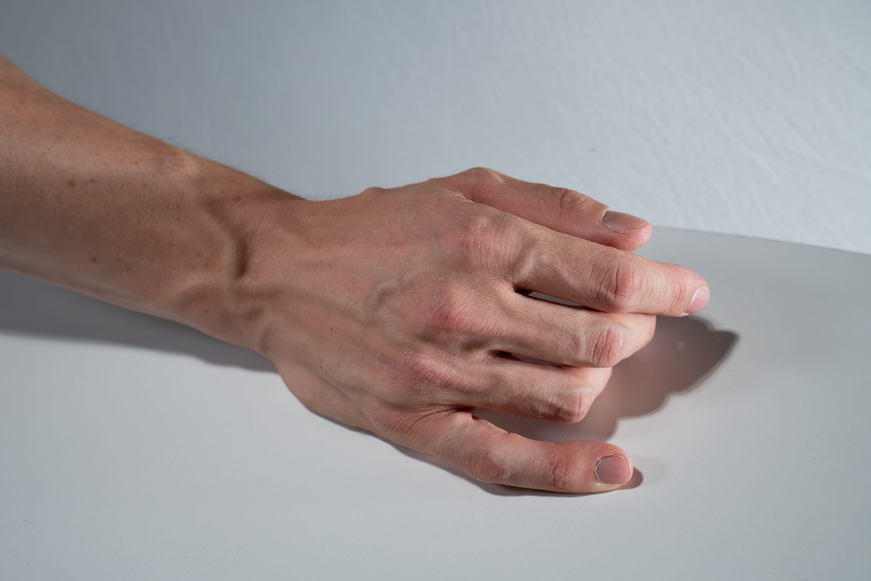 a closeup image showcasing the back of a man's hand resting on a white surface. the hand is slightly curled, with prominent veins visible along the arm and hand. the image is illuminated by soft lighting, casting a subtle shadow beneath the hand. the perspective allows for a detailed view of the skin texture and fingernail details.