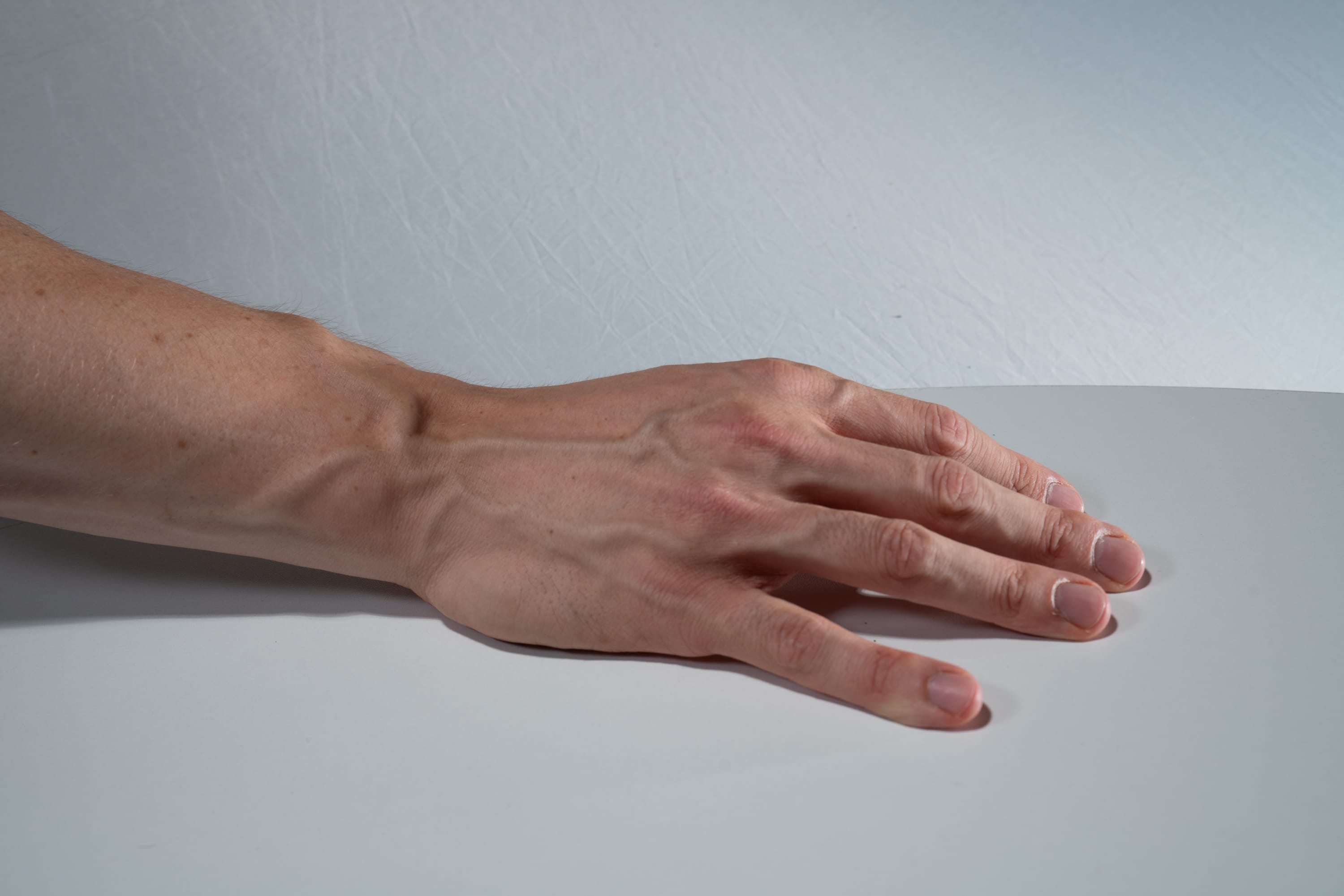 the image is a closeup shot of a man's hand and arm. the hand is resting on a white surface. the image highlights the veins on the back of the hand and arm. the lighting is strong, casting distinct shadows.