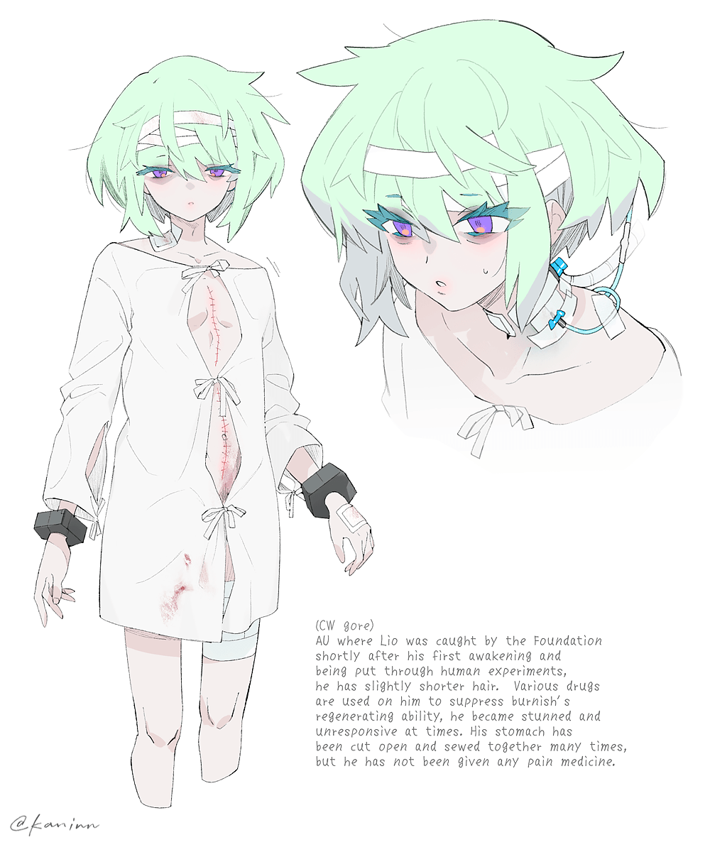the image is a drawing of an anime girl with green hair. she is dressed in a white shirt and has bandages on her head and arms. she has blood on her shirt and looks to be injured. the caption explains that she is a burnish who has been caught by the foundation and is being used in human experiments. the girl has been cut open and stitched many times, but she has not been given any pain medicine. this suggests that the girl is in pain and suffering. the image is a dark and disturbing one, as it depicts the suffering of a young girl who is being used for research.