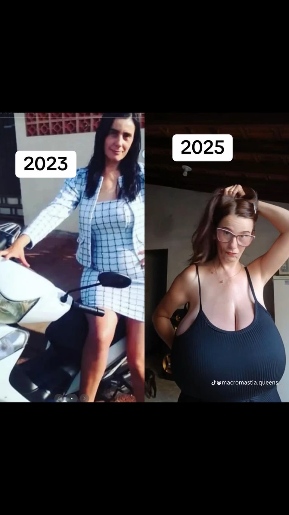 a before and after image showing a woman in 2023 with smaller breasts, and the same woman in 2025 with large breasts. the change is most likely due to plastic surgery.
