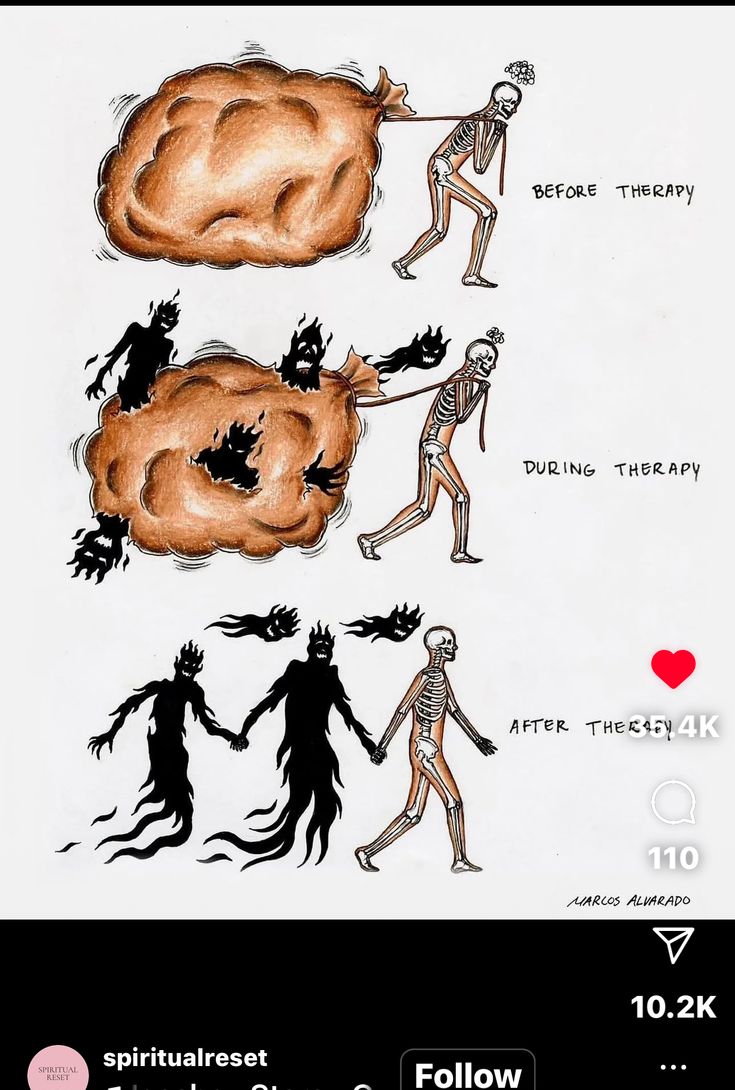 the image is an illustration showing the stages of therapy, depicted through a skeleton figure pulling a large, brown bag. the first panel labeled "before therapy" shows the skeleton figure hunched over, struggling to pull the large bag, with a small brainlike object above its head. the second panel labeled "during therapy" shows the bag emitting shadowy figures and flames, with the skeleton still pulling it. the third panel labeled "after therapy" shows the skeleton figure walking upright, holding hands with two shadow figures, now seemingly integrated. the illustration conveys the journey of dealing with emotional baggage and inner demons through therapy, leading to integration and acceptance. the image is by marcos alvarado.