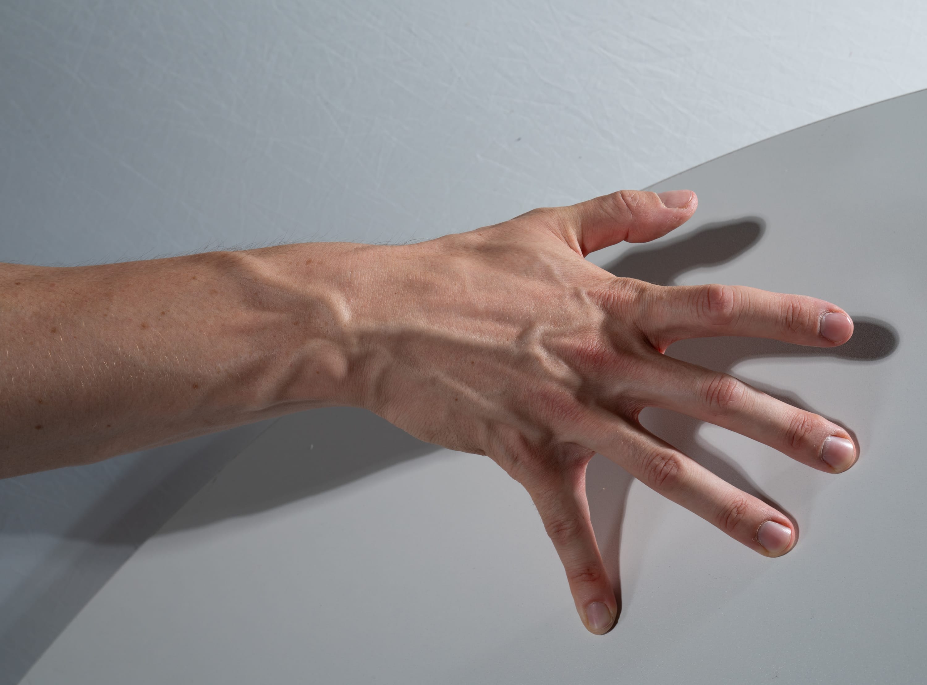 a closeup image of a person's hand and forearm resting on a smooth, light gray surface. the hand is splayed open, with the fingers slightly curled. the lighting is artificial and direct, casting strong shadows on the table. the image prominently features the person's veins, which are highly visible due to the lighting and the closeup perspective.