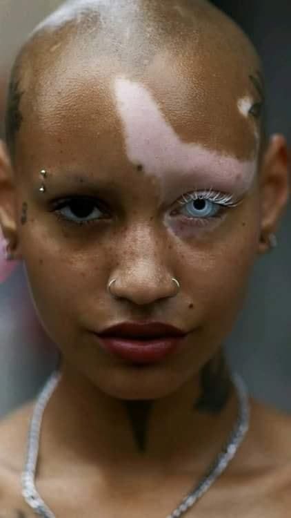 a close up portrait of a woman with vitiligo. she is looking directly at the camera. her skin is a mixture of light and dark patches. she is wearing a nose ring, a necklace and has shaved head.