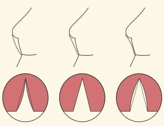 the image shows three different types of bra fits. each bra fit has an illustration of the side profile and a diagram of the bra cup. the first bra fit shows a bra that is too small, with a bra gap in the cup. the second bra fit shows a bra that fits correctly, with no bra gap. the third bra fit shows a bra that is too big, with excess space in the cup.