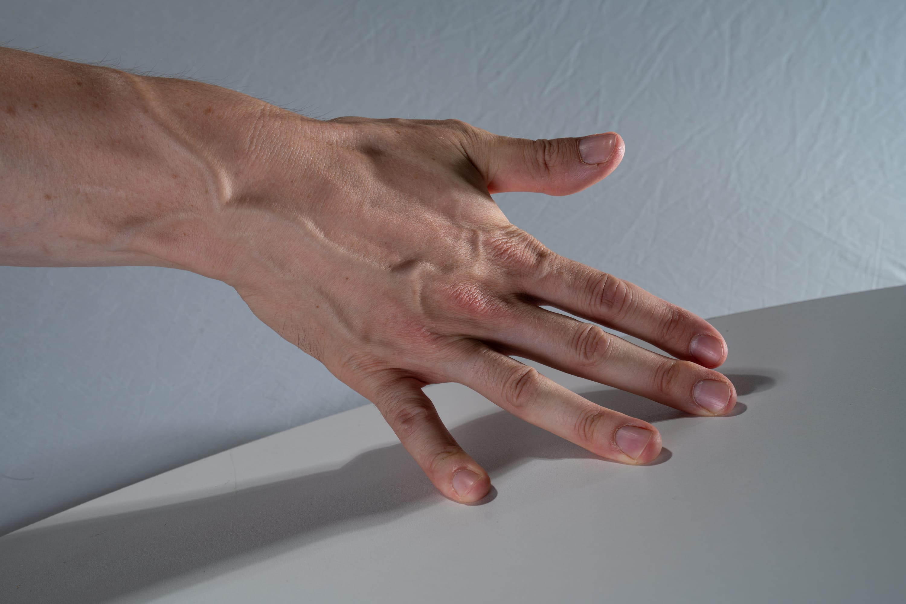 the image shows a closeup view of a caucasian hand resting on a white surface. the hand is positioned palm down with fingers slightly spread, revealing prominent veins and the texture of the skin. the lighting is bright and artificial, casting subtle shadows that highlight the contours of the hand.