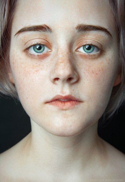a closeup portrait of a young woman with fair skin and blue eyes. she has many freckles scattered across her face.