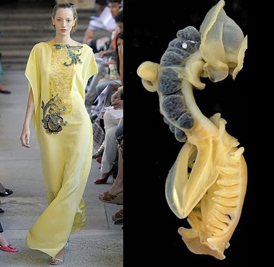 a fashion model wearing a long yellow dress with embroidery is walking the runway. she is looking to the left and is posing in a way to show the detail of the dress.  on the right side of the image is a close up of a sea shell, with a blurry background.