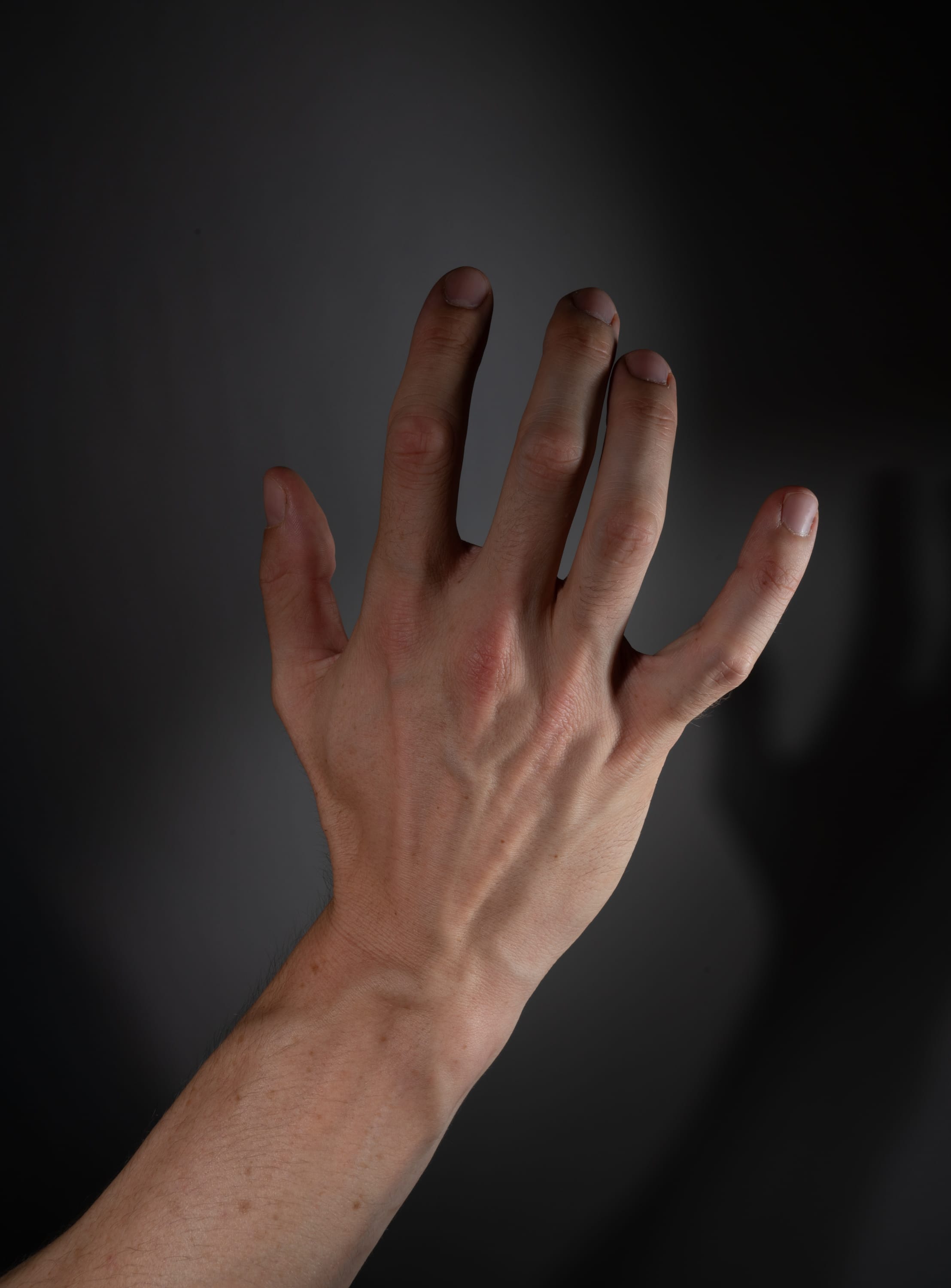 the image shows a hand with its fingers spread out against a gray background. the hand is illuminated by studio lighting, creating a clear shadow on the background. the image highlights the texture of the skin and the prominent veins on the back of the hand.