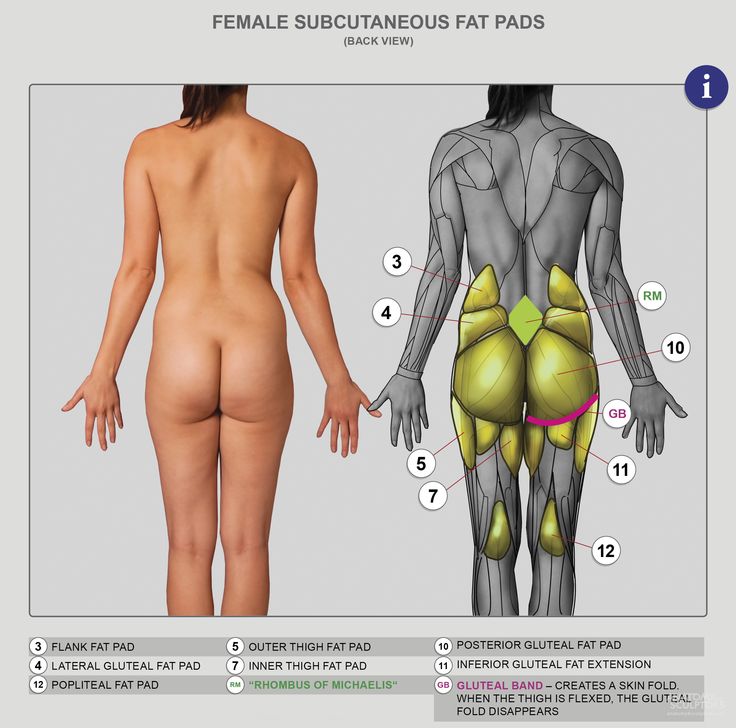 an anatomical diagram of the female body, from behind, showing the locations of various subcutaneous fat pads.