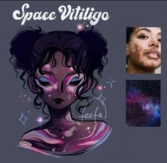the image is a stylized portrait of a black woman with vitiligo. her skin is a rich brown, and the vitiligo patches are depicted as swirling galaxies of purple, pink, and blue. she has large, expressive eyes with white pupils, and her hair is styled in two space buns. the background is a deep indigo blue, and the overall effect is one of cosmic beauty. a smaller image of a real person with vitiligo is included in the top right corner.