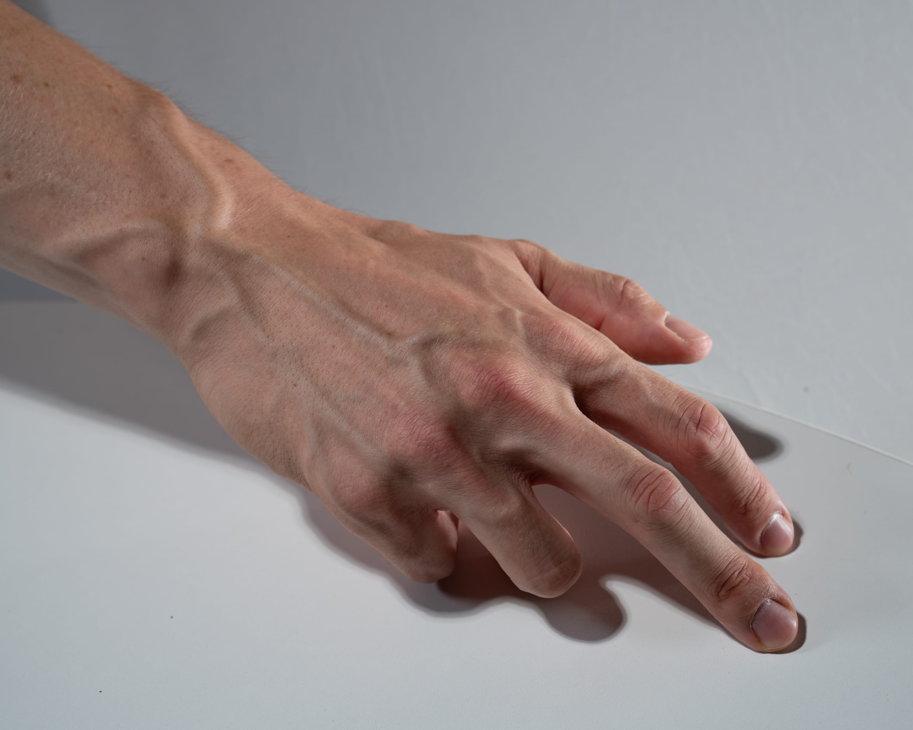 the image showcases a closeup view of a hand and forearm, prominently displaying the intricate network of veins beneath the skin's surface. the hand is positioned palmdown on a smooth, white surface, with the index and middle fingers extended, while the ring finger and pinky remain curled. the studio lighting accentuates the subtle variations in skin tone and highlights the prominent veins, giving the image a clinical and anatomical feel.