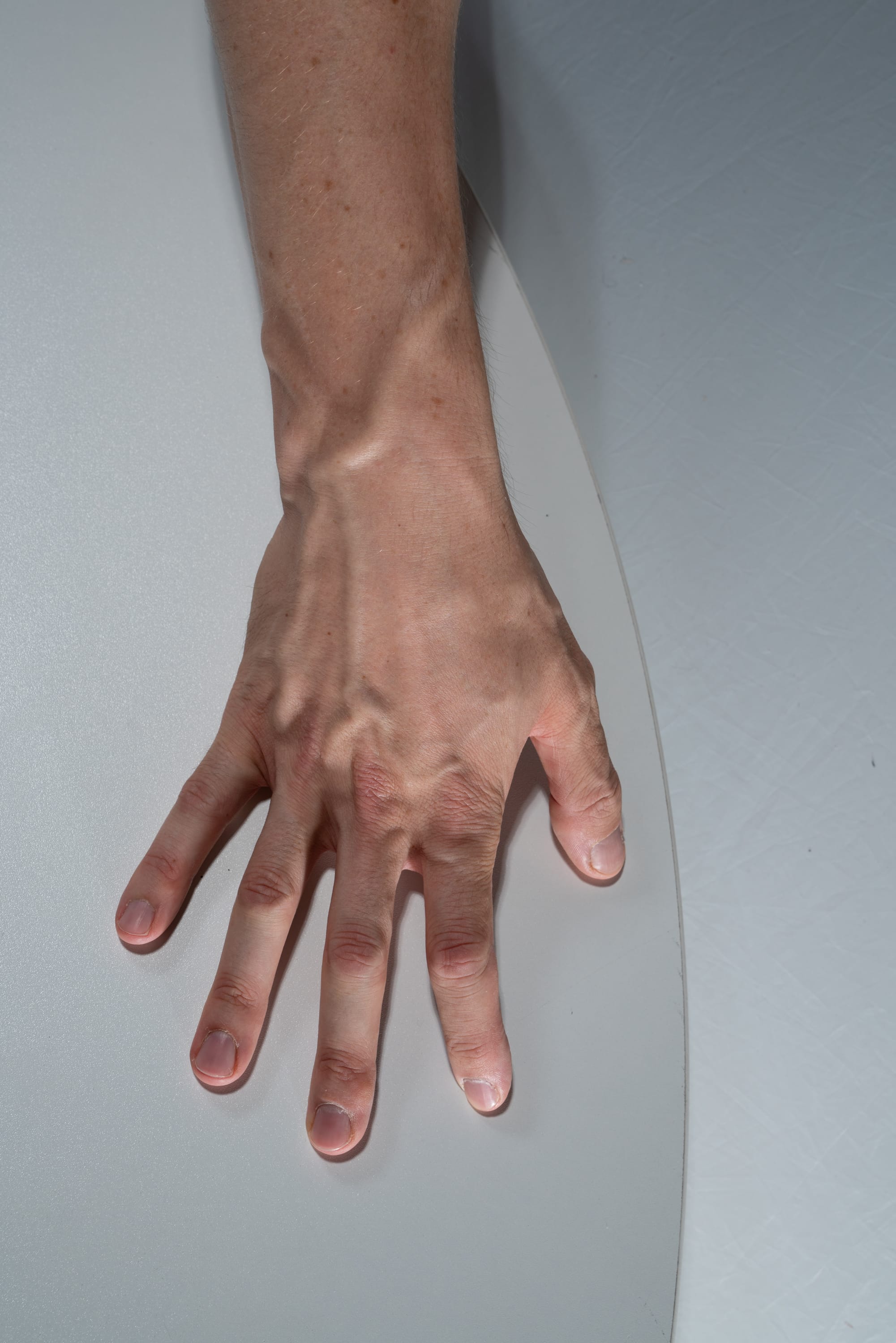a pale hand with visible veins rests on a smooth, white surface. the image is taken from a topdown perspective, showcasing the length of the arm and the delicate details of the hand. the lighting appears to be controlled studio lighting, creating a stark contrast against the pale skin tones.