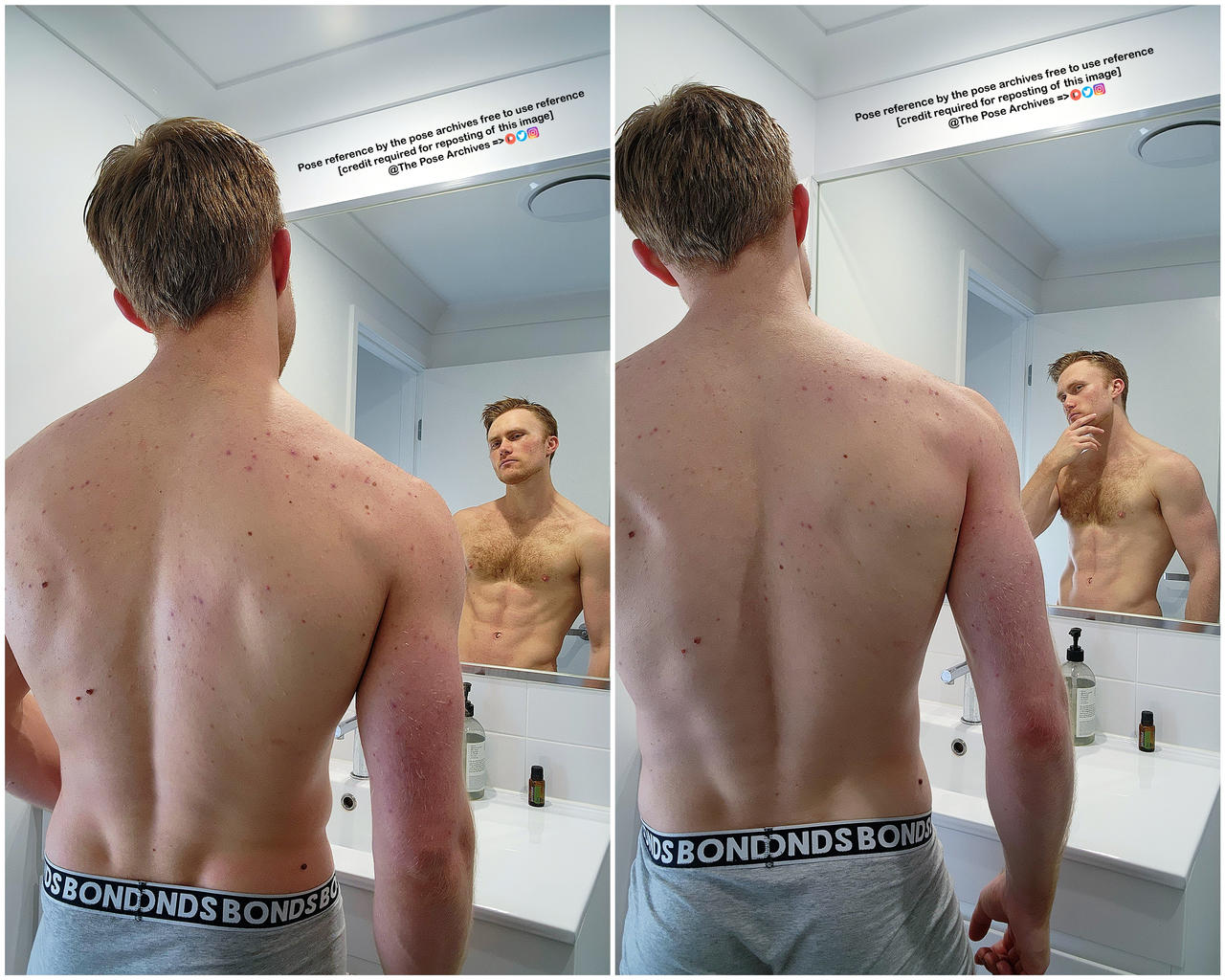 a collage of two images featuring the same man standing in his bathroom. in both images, he is facing a mirror and showcasing his back, which has acne. in the left image, his facial expression is neutral, while in the right image, he's looking at his reflection with a thoughtful expression. his outfit and the bathroom setup remain consistent in both photos.