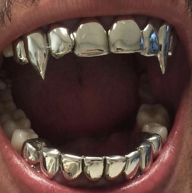 a closeup image of a person's mouth with a silver grill on their teeth. the grill covers the front teeth and has a pointed, fanglike design. the person's mouth is open, revealing the grill and their tongue. the lighting is dim and the image is slightly blurry. the overall tone of the image is edgy and urban.