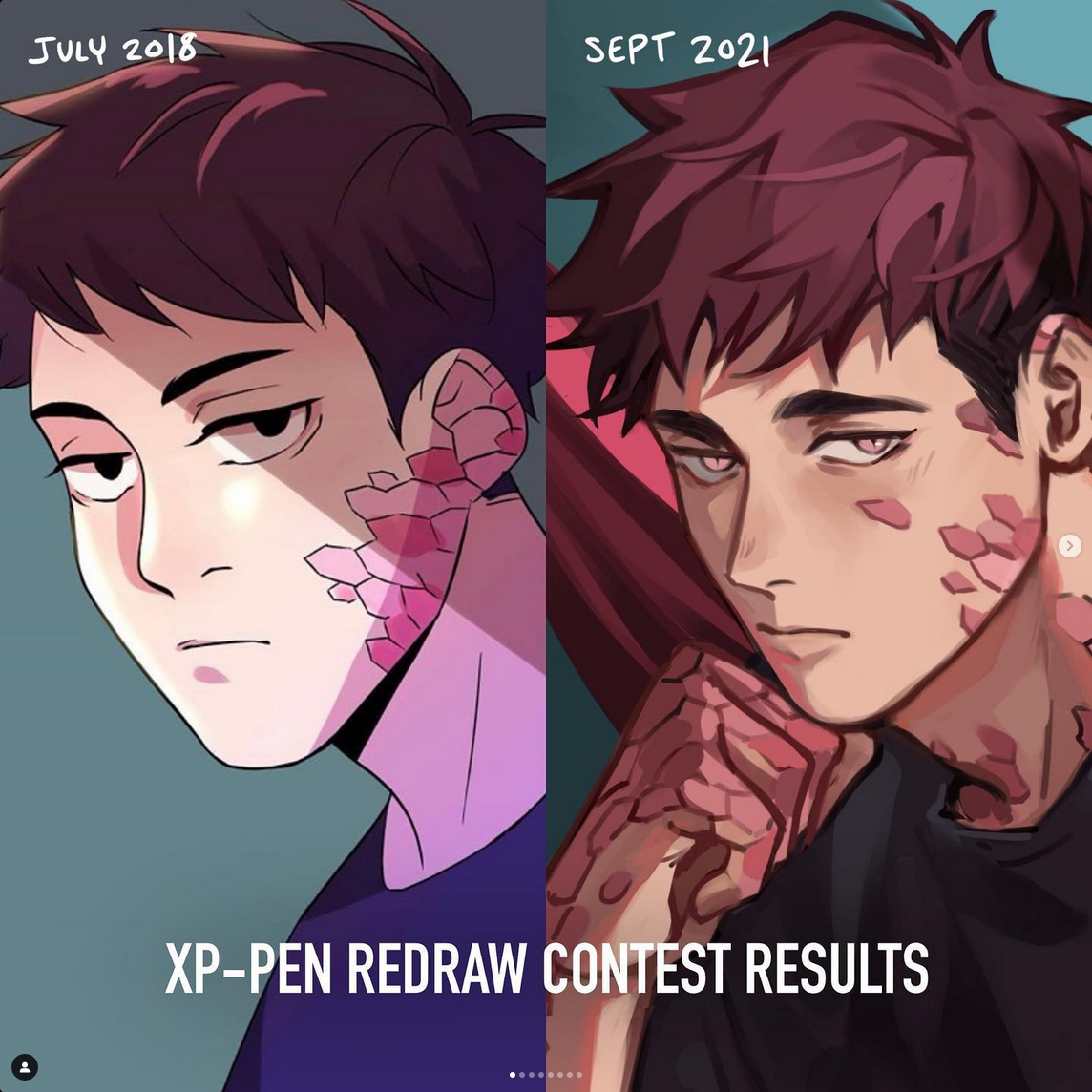 the image shows a beforeandafter comparison of a digital art piece. it's likely an entry for an xppen redraw contest. the left side, dated july 2018, presents a simpler portrait of a young man with pink markings on his face. the right side, dated september 2021, showcases significant improvement in the artist's skill. the character is more detailed, the anatomy is more accurate, and the overall composition is more dynamic and visually appealing. the color palette and lighting have also been refined, creating a more polished and professional look.