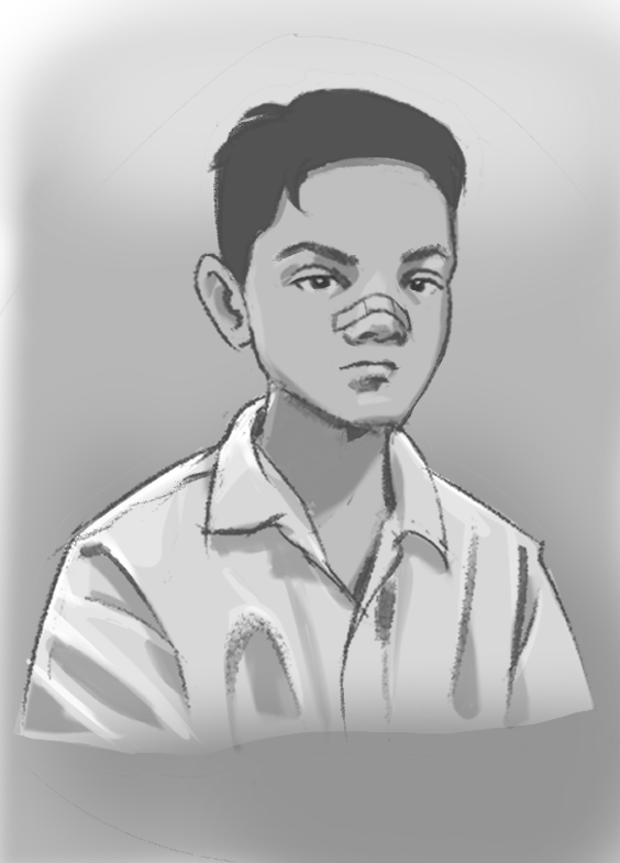 a black and white sketch of a young boy with a serious expression. he has a bandage on his nose and is wearing a simple shirt. the drawing style is loose and gestural, focusing on the basic forms of the boy's features. the background is a solid gray.