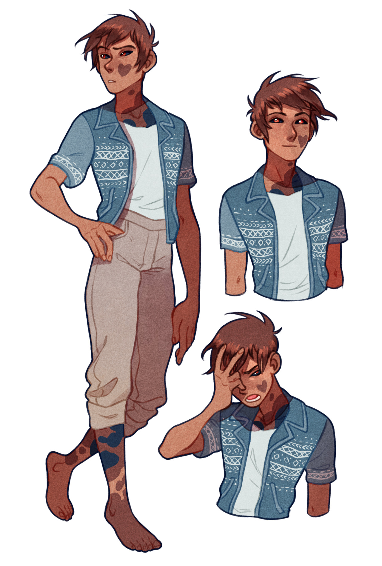 a digital illustration of a young man with brown hair and vitiligo.  he is shown in three poses wearing a white tshirt, blue patterned overshirt and tan pants. he is barefoot and has brown eyes.  this image appears to be a character design or concept sheet.