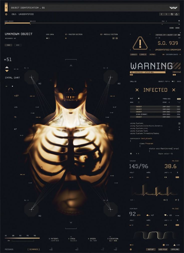 the image shows a futuristic medical scan or interface, displaying a skeletal structure of a human torso. the ui elements include warnings, data charts, and various measurements like blood pressure and heart rate. it suggests a scenario where the subject is infected, indicating a health crisis or anomaly detection system. the overall aesthetic is technical and clinical.