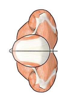 the image is a detailed anatomical illustration of the human back muscles from a topdown perspective. it showcases the superficial muscle layers, including the trapezius, latissimus dorsi, and rhomboid muscles, with clear definition and shading to highlight their form and structure.