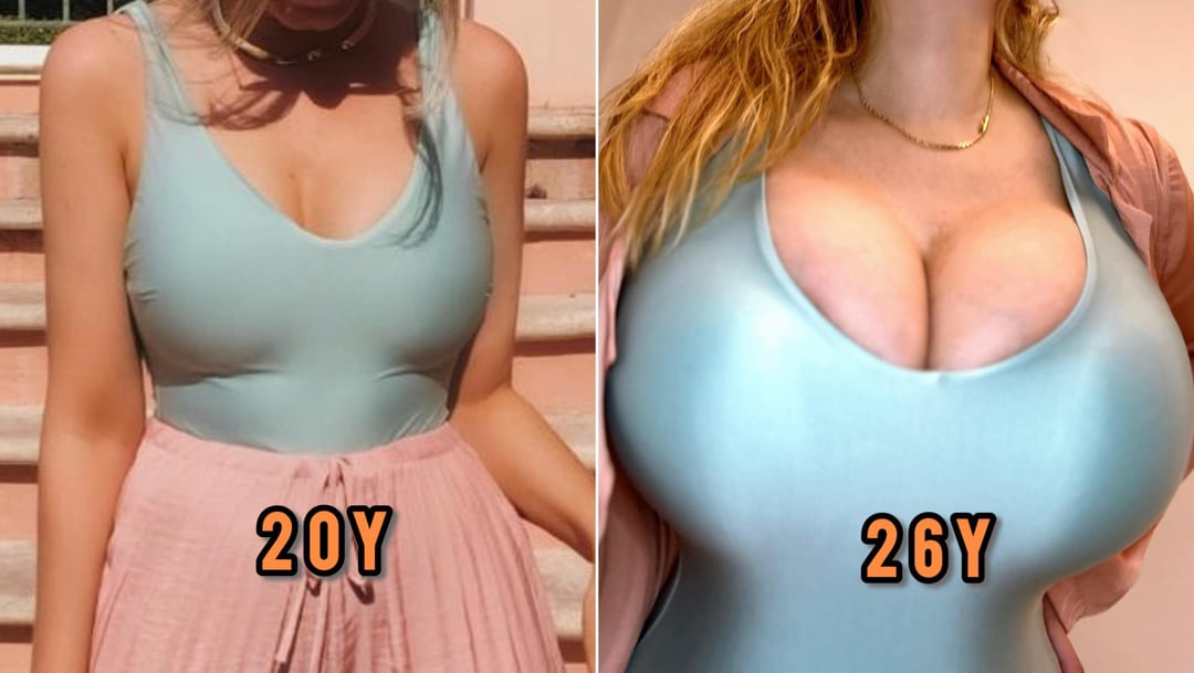 a split image showcasing a woman's body at two different ages: 20 years old (left) and 26 years old (right).  both images feature the woman wearing a similar light blue, vneck bodysuit.  at 20, she is wearing a pink skirt; at 26, she's wearing a different, more formfitting garment, revealing a significant increase in breast size. the difference in body shape and breast development is clearly emphasized. the images highlight natural body changes over time.
