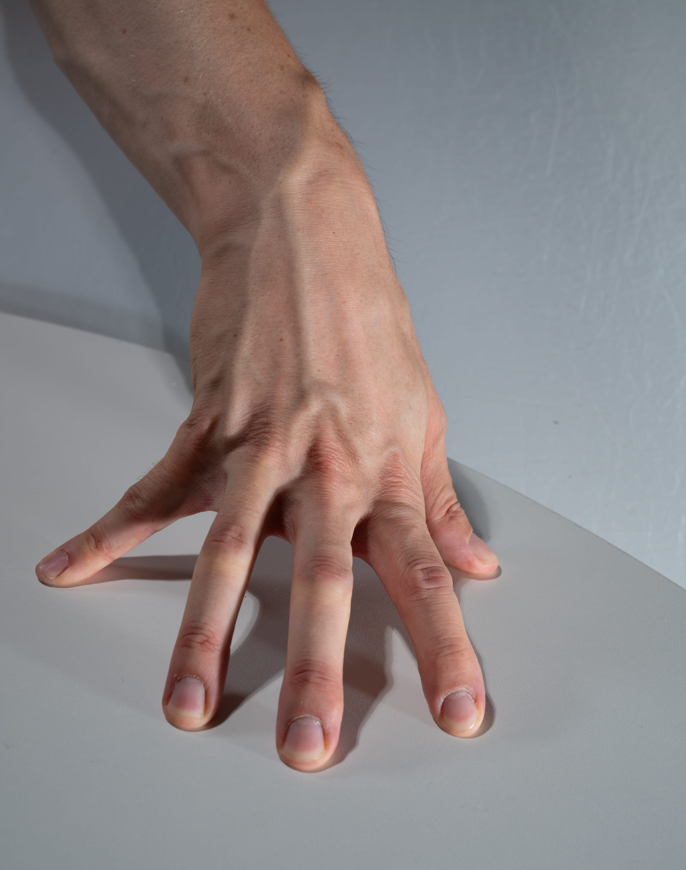 a closeup shot of a person's hand resting on a white surface. the hand is extended, with the fingers spread apart. the veins in the hand and arm are visible. the lighting is artificial, creating a clinical feel.