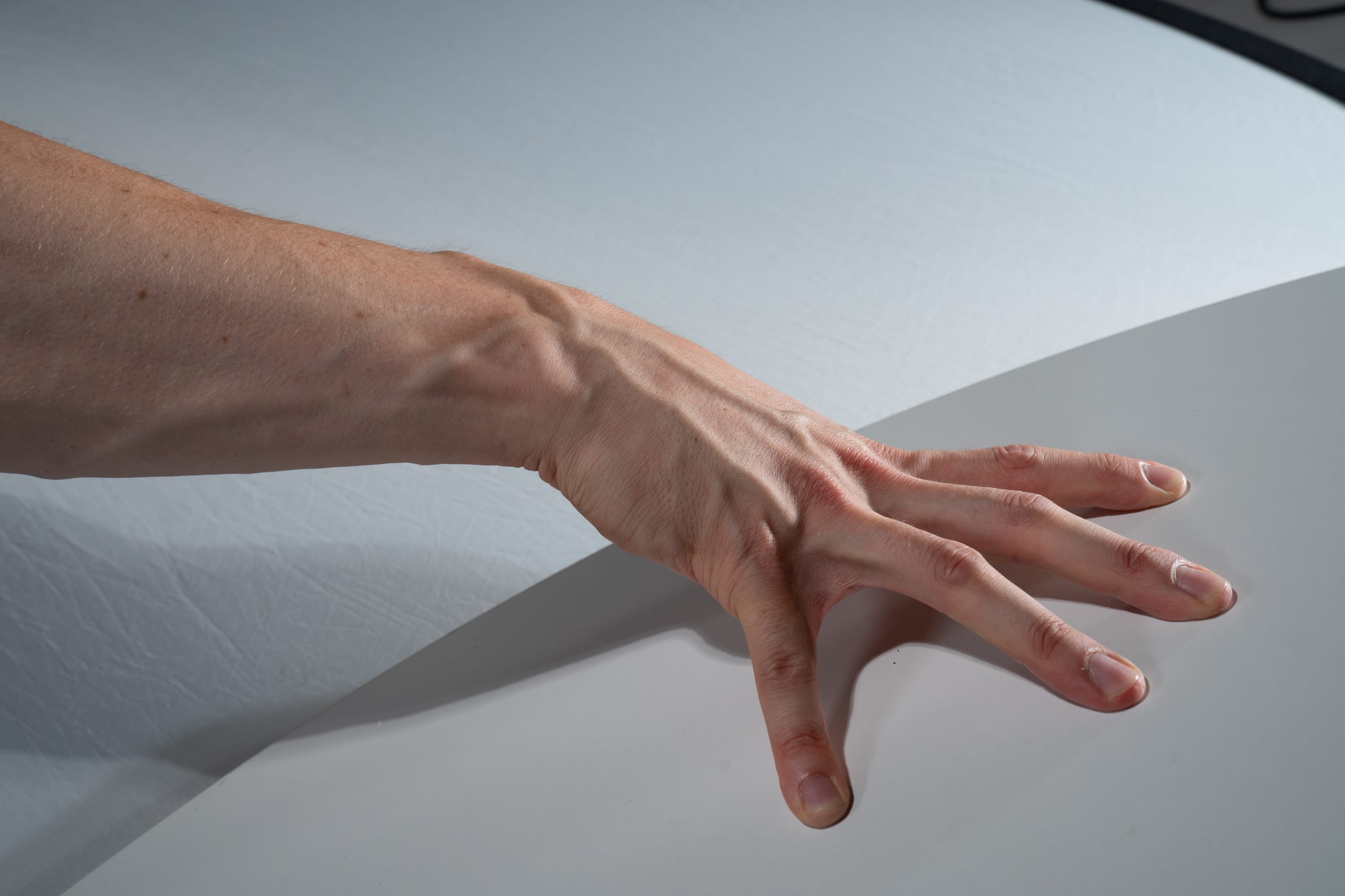 the image shows a closeup view of a caucasian adult's right arm and hand, resting on a white surface. the studio lighting accentuates the details of the skin, veins, and tendons. the hand is outstretched with the fingers slightly spread apart.  the arm extends from the left side of the frame and ends at the wrist where the hand begins. the hand is positioned in the centerright of the frame. the background is a solid white, providing a neutral backdrop for the arm.