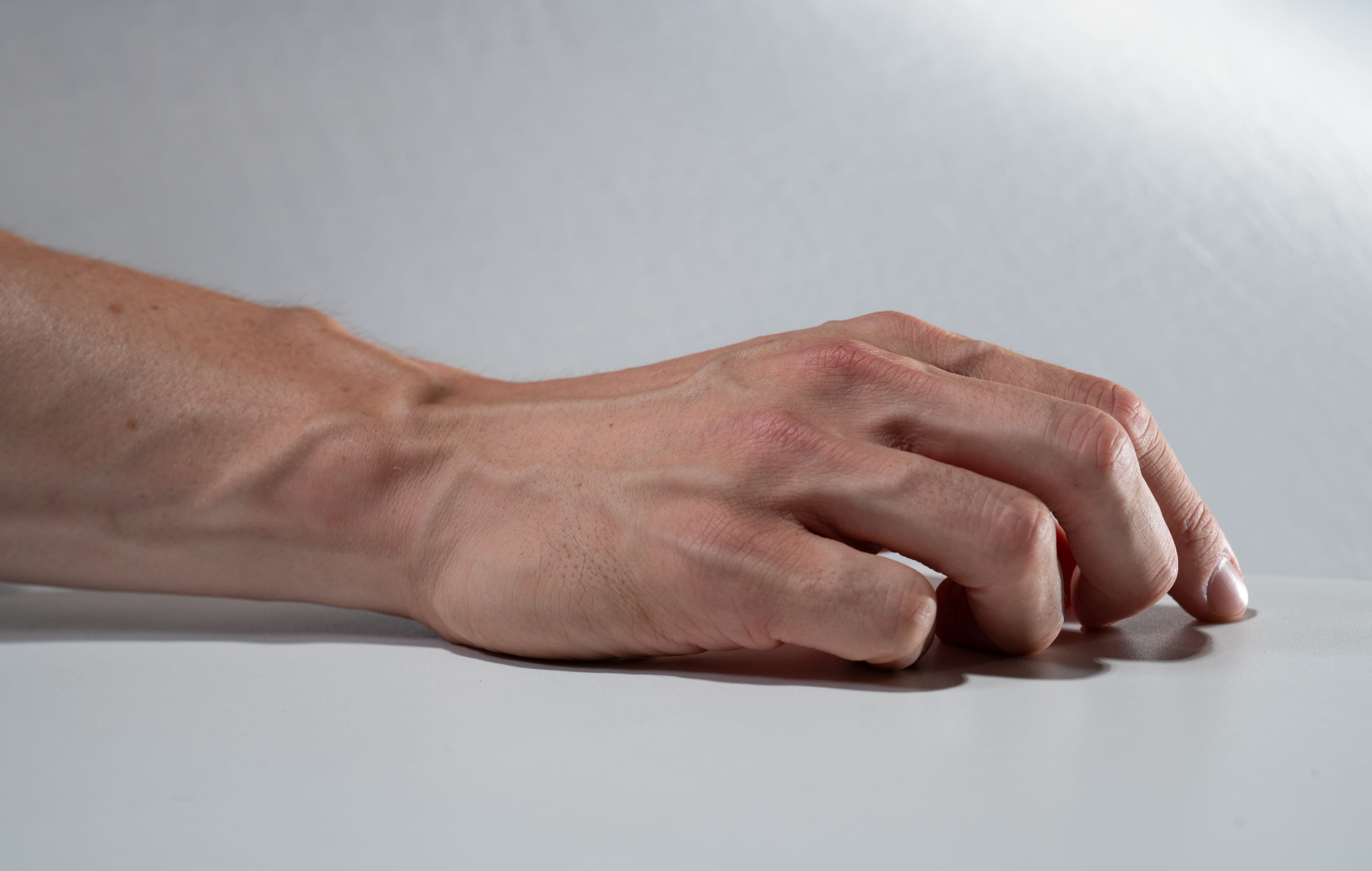 an image of a fairskinned hand resting on a white surface. the image highlights the details of the skin and the visible veins on the arm and hand.  the hand is slightly curled, and the fingers are relaxed. the lighting is soft and even, creating subtle shadows that emphasize the contours of the hand and arm.