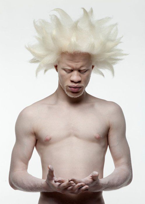 a portrait of a man with albinism. he is sitting in a studio setting and is looking down. he has white blonde hair and a bare chest. his skin is very pale. he is holding his hands together in front of him, and his palms are visible.