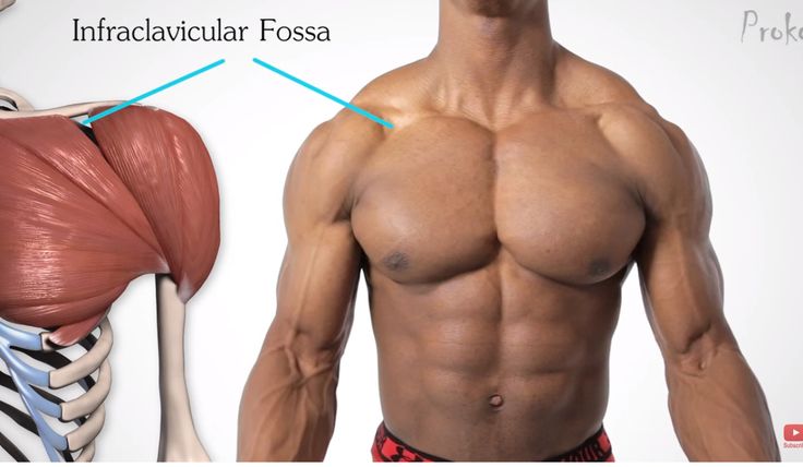 the image shows the anatomy of the shoulder, including the clavicle and the infraclavicular fossa. the image is split into two parts: a diagram of the shoulder muscles and a picture of a muscular male shoulder. the infraclavicular fossa is labelled on both images. the infraclavicular fossa is a depression located below the clavicle. it is a common site for injections and for the insertion of surgical instruments.